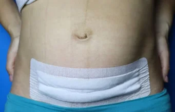 दून के निजी अस्पताल में डिलीवरी के बाद महिला के पेट में छूट गई कॉटन पट्टी, मौत