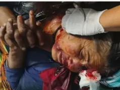 बड़ी खबर: लैंसडौन में महिला पर जंगल में अचानक भालू ने किया हमला, गंभीर हालत में एम्स ऋषिकेश रेफर