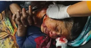 बड़ी खबर: लैंसडौन में महिला पर जंगल में अचानक भालू ने किया हमला, गंभीर हालत में एम्स ऋषिकेश रेफर