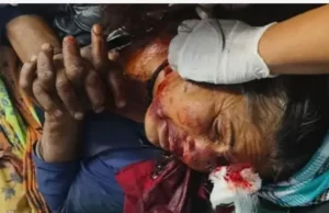 बड़ी खबर: लैंसडौन में महिला पर जंगल में अचानक भालू ने किया हमला, गंभीर हालत में एम्स ऋषिकेश रेफर