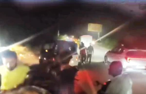 पटेलनगर में बैंककर्मी पर फायरिंग, पेट को छूकर निकली गोली; बाइक सवार युवकों की तलाश में जुटी पुलिस