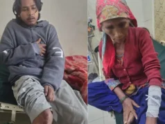 चमोली में भालू का हमला, एक ही परिवार के चार लोग घायल; हायर सेंटर रेफर