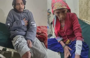 चमोली में भालू का हमला, एक ही परिवार के चार लोग घायल; हायर सेंटर रेफर